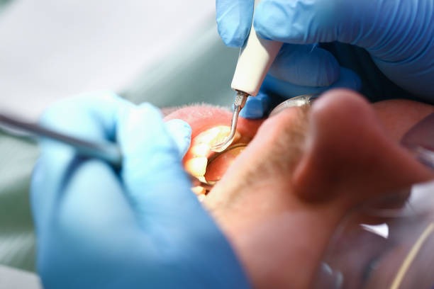Best Pediatric Emergency Dentist in Hazel Park, MI