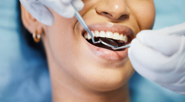 Best Emergency Treatment for Dental Infections or Abscesses in Hazel Park, MI