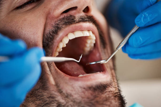 Best Emergency Tooth Extraction in Hazel Park, MI